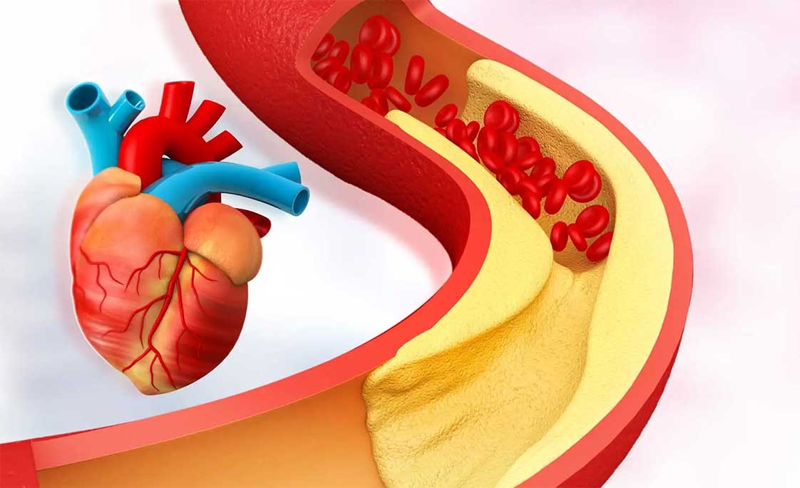 Yến mạch nguyên hạt hỗ trợ giảm cholesterol và tốt cho tim mạch